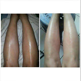 45pcs Knuckle Set Budget size