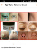 Jailev's Warts Remover Cream 100g (Mild)