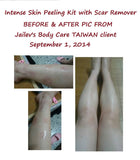 Intense Skin Peeling Scar Remover Kit ISPSR 60ml kit