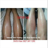 Intense Skin Peeling Scar Remover Kit ISPSR 60ml kit