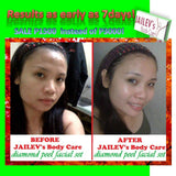 PROMO Diamond Peel Facial Kit