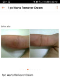 5pcs Jailev's Warts Remover Cream 5g
