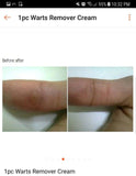 5pcs Jailev's Warts Remover Cream Mild 10g