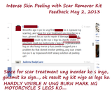Intense Skin Peeling Scar Remover Kit ISPSR 60ml kit