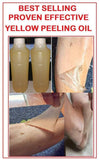 10pcs Jailev's Peeling Oil 1 Liter