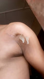 30ML Intense Skin Peeling Scar Remover Kit (ISPSR)