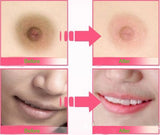 10pcs Pink Lips and Nipple Cream 10grams